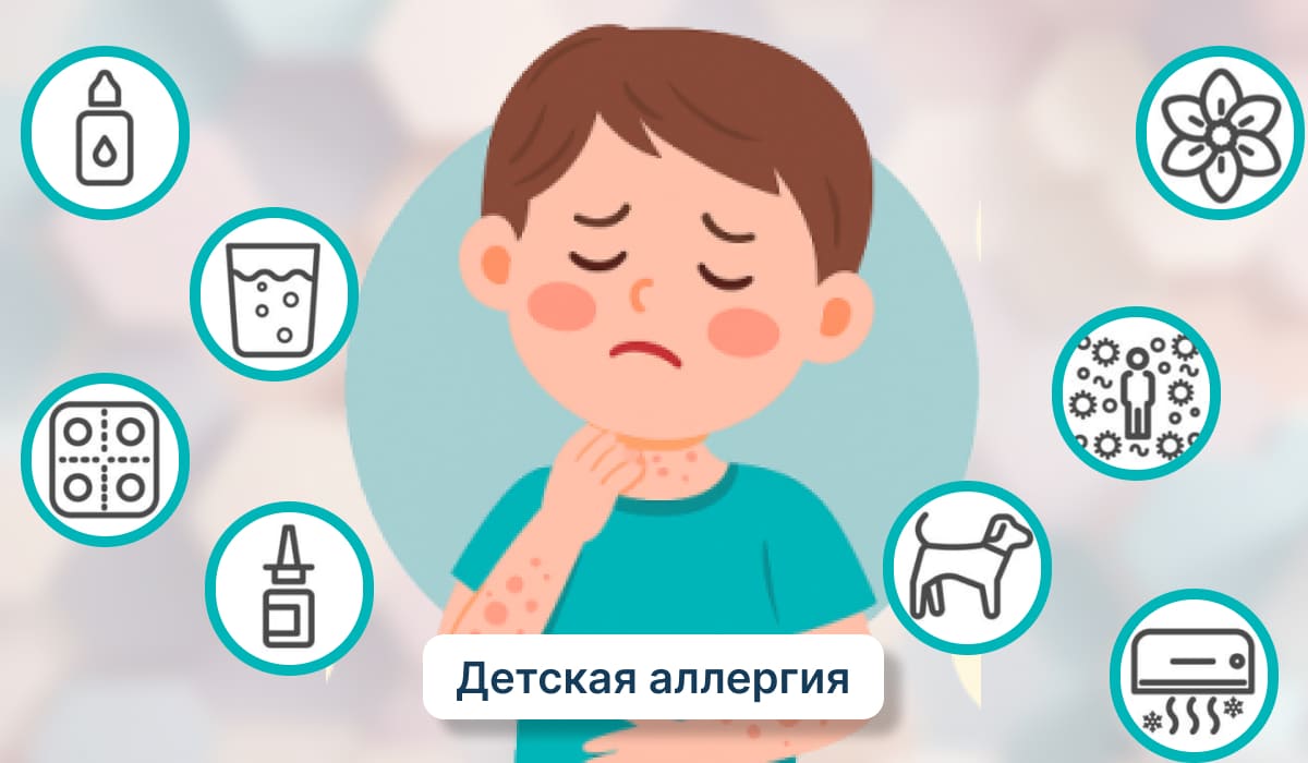 Иллюстрация мальчика с сыпью и зудом на коже, вокруг иконки возможных аллергенов.